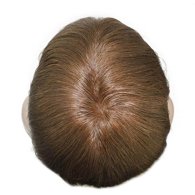 NJC1895-womens-skin-toupee-6