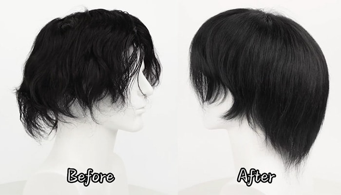 5-hair-thinning-before＆after-1