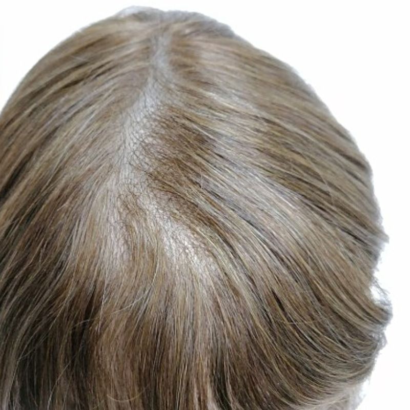 Super-Thin-Skin-Hair-System-0.06mm-with-4-Scallop-Front-3