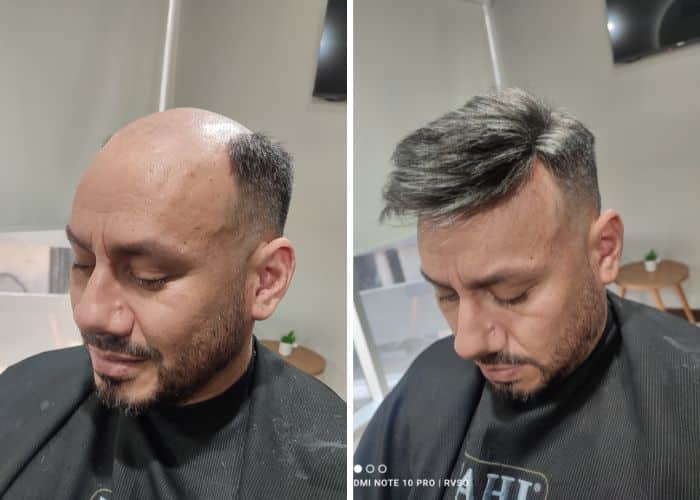 toupee-hairstyle-beforeafter-4