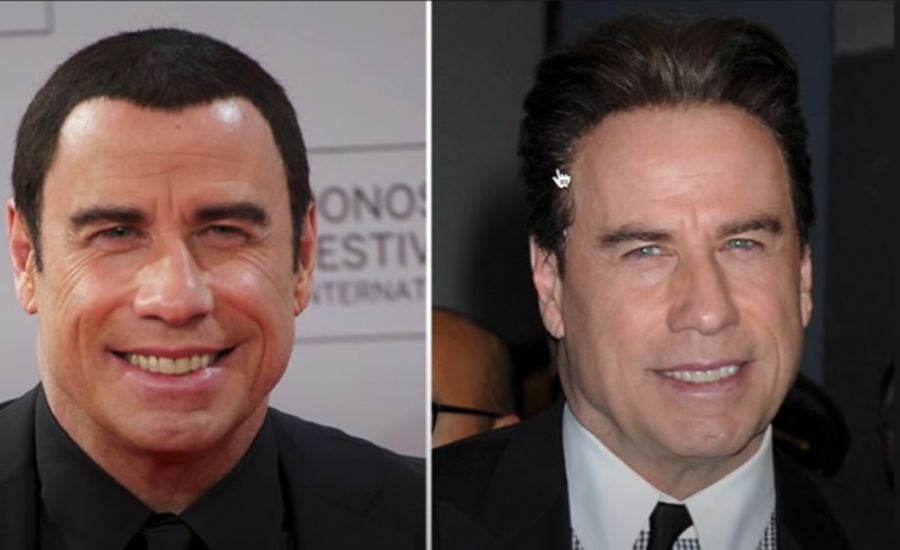 John-Travolta-wig-hairline