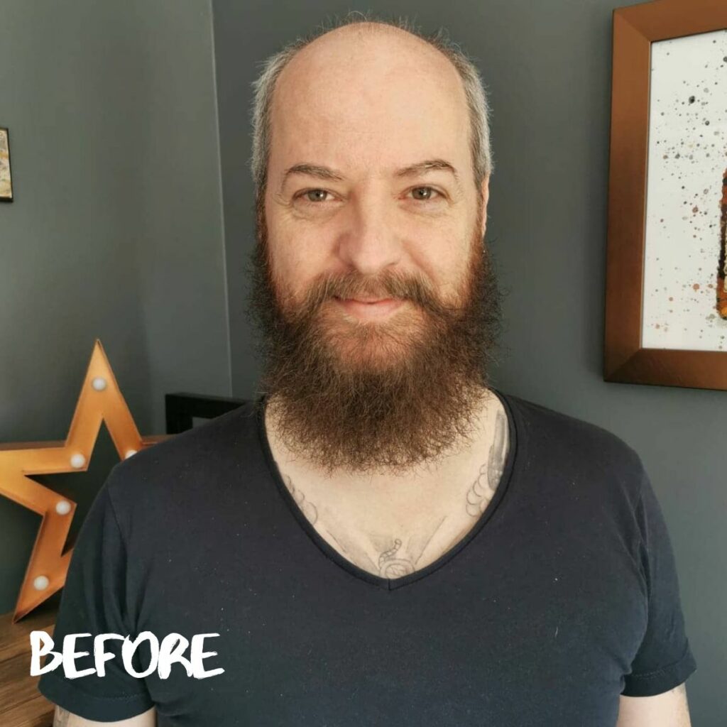 before-wearing-a-hair-system-before-and-after-1