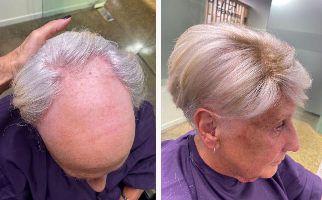 haircuts for balding women Angled Undercut for Elderlies
