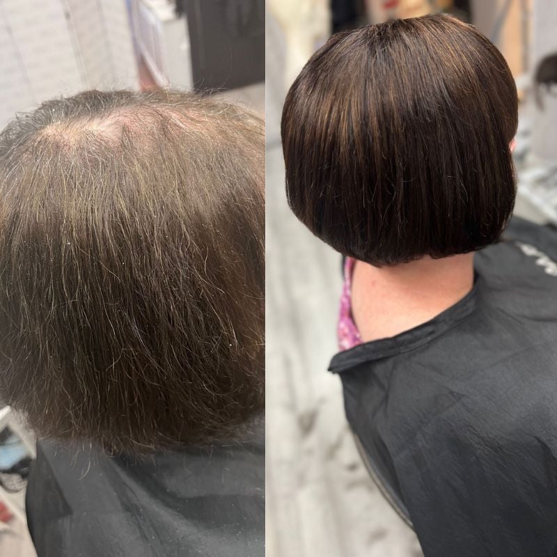 PES5.5X6 integrated hair topper before and after